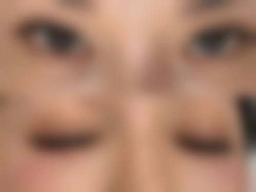 诊疗特色总结 张建亮 面部年轻化 自体脂肪塑形