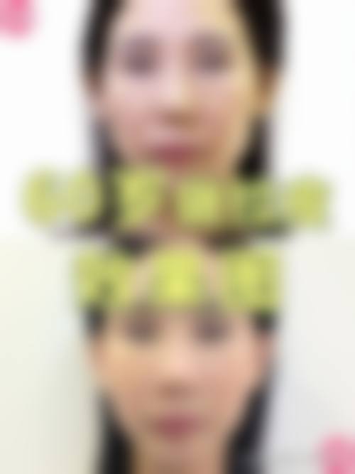六、邯郸韩雅外科整形门诊价格表