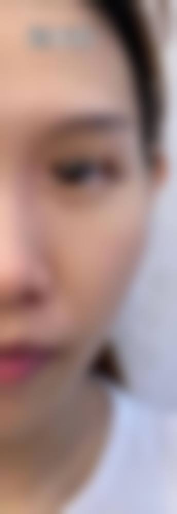三、无锡爱思特整形美容医院诊疗项目有哪些?