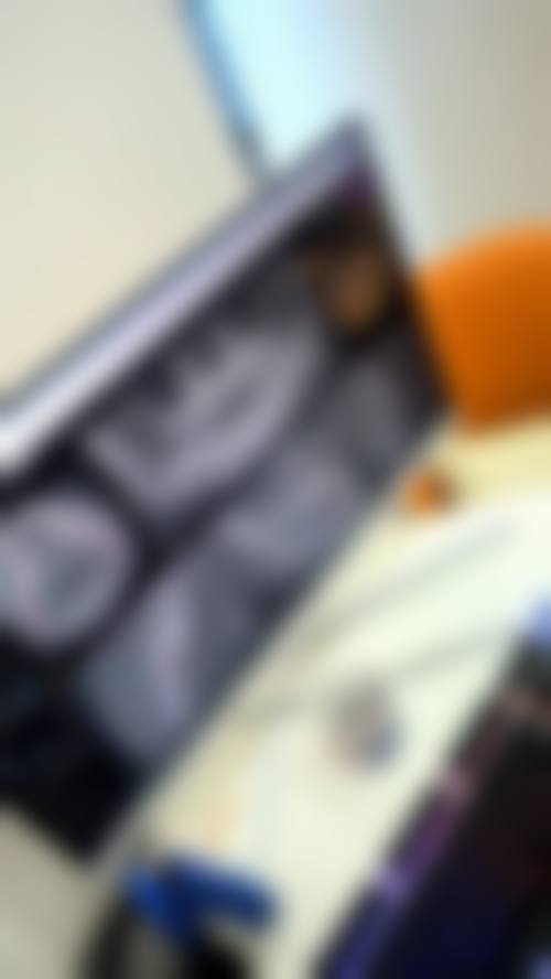 优惠活动详情:限时补贴与透明政策