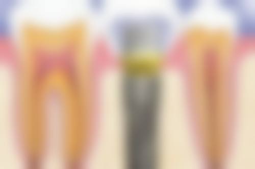 高端诊疗设备与技术保护