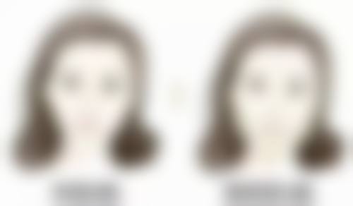 五、曼托隆胸术前需要做的检查