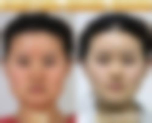 五、南宁联韩整形美容诊所价格表