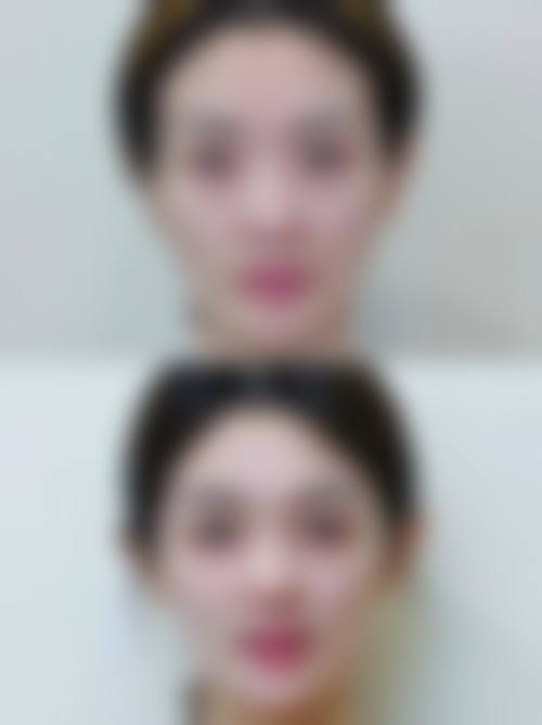 四、韩国City7整形外科医院特色项目