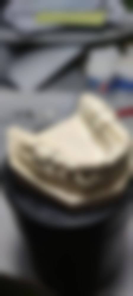 结语:选择正规口腔,从一份值得信赖的方案开始