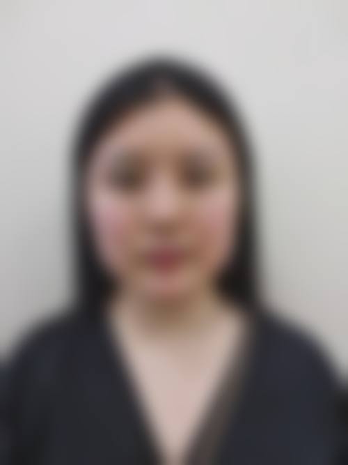 八、焦作嘉美医疗美容诊所真实的患者评价