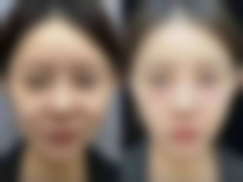 九、苏州韩奥医疗美容诊所真实的患者评价