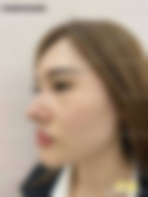 二、陈长英擅长项目