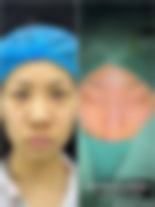 四、李秀玄收费价格表