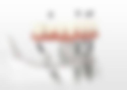 优惠活动详情:原价对比,省钱看得见