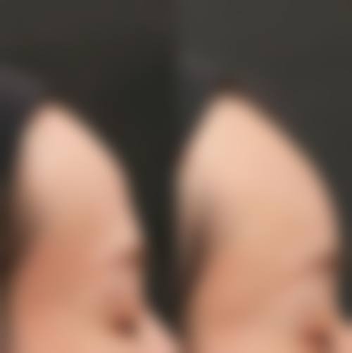 优惠活动详情—现在有什么优惠?