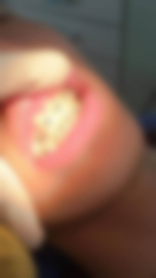 选择丰盛口腔诊所