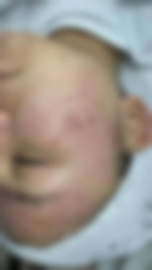 常见疑问解答