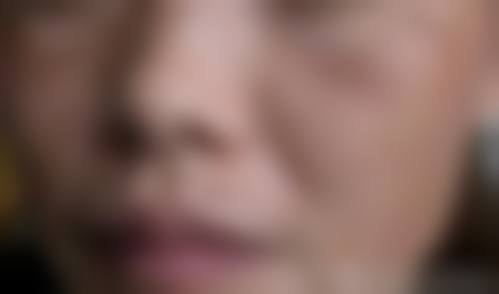 患者真实评价
