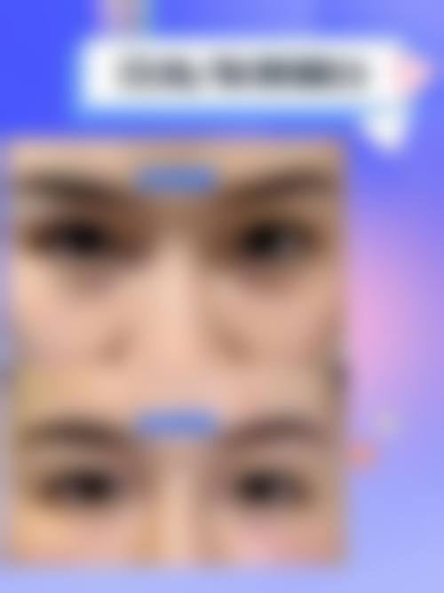 二、益阳赫山韩美整形医院怎么样?