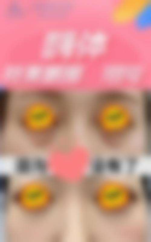 八、益阳赫山韩美整形医院真实的患者评价