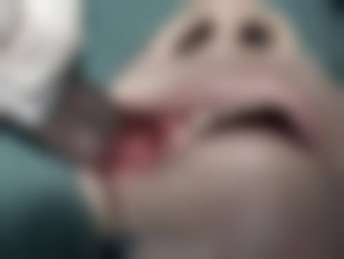 患者真实评价