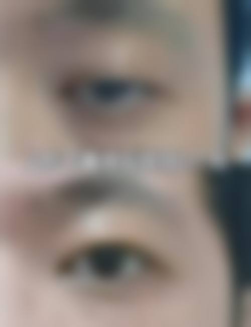 临床实例分享