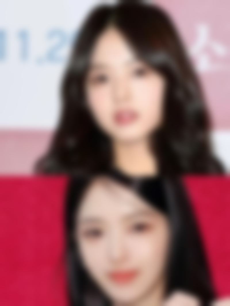 二、微创双眼皮是恒久的吗