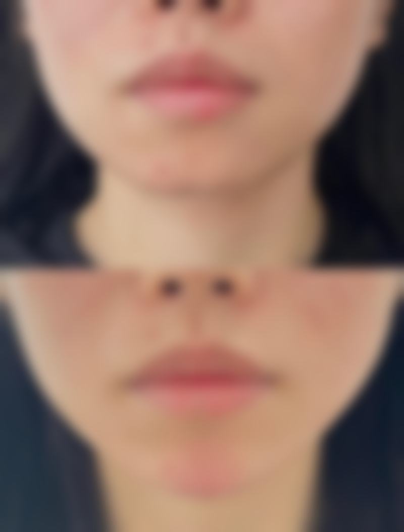 三、美带三分钟去眼袋的原理探讨