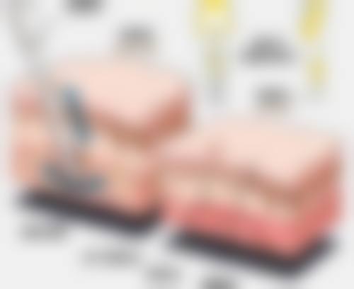 三、邓良树技术优势