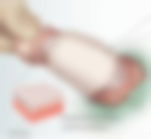 四、耳朵长疤痕疙瘩就医前的注意事项