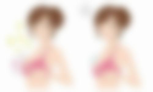 五、有眼袋法令纹的手术治疗方法