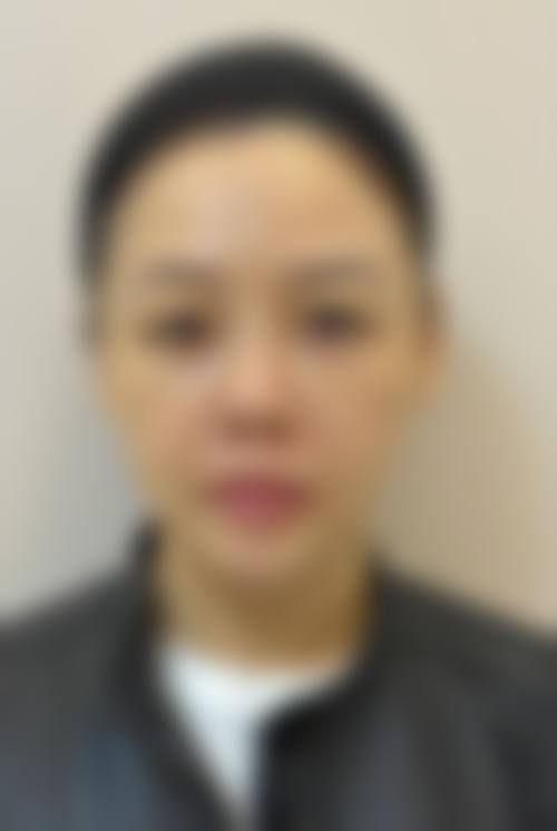 临床实例分享