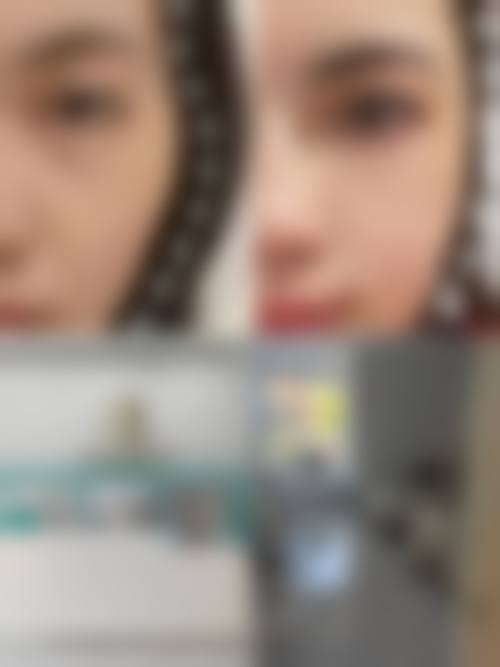 八、成都华漾医疗美容诊所真实的患者评价