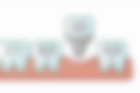 优惠活动详情:透明收费,高性价比