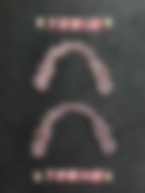 限时优惠活动详情