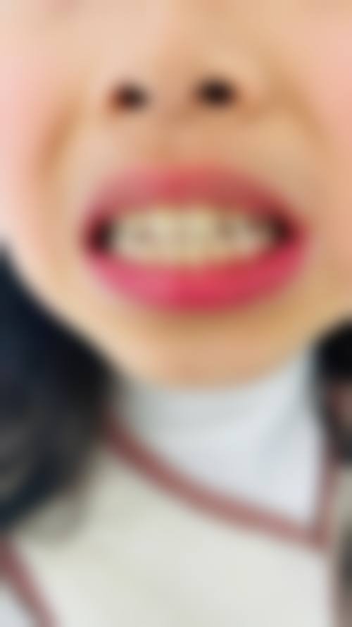 结语：选择正规专精的口腔机构