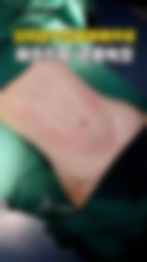 五、王鑫凤怎么预约？