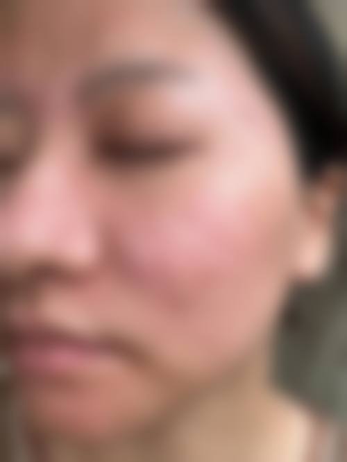 临床实例分享