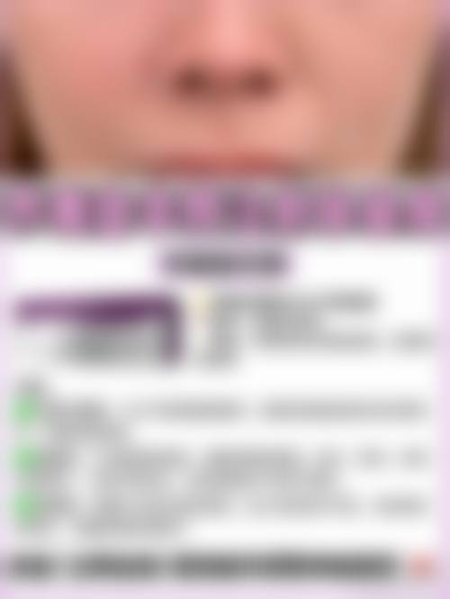 预约优惠活动