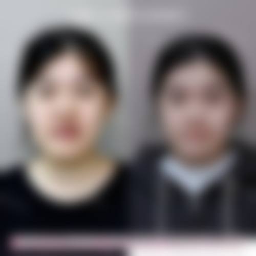 临床实例分享