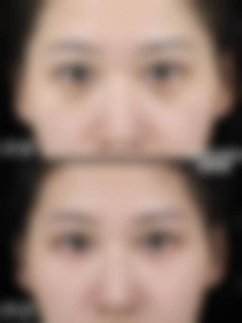 擅长项目详解