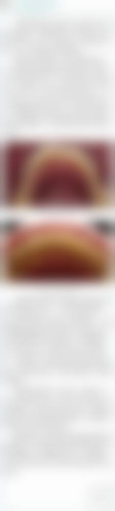 结尾:选择朗德,绽放自信笑容