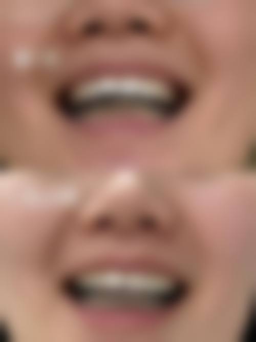 限时优惠活动说明:实惠看牙好选择