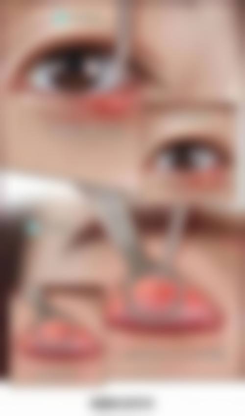 设备环境介绍：精细检测与层流手术环境