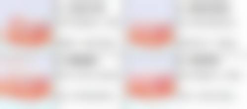 四、肋软骨隆鼻变形的预防措施
