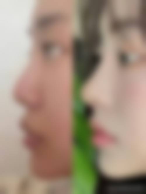 擅长项目详解