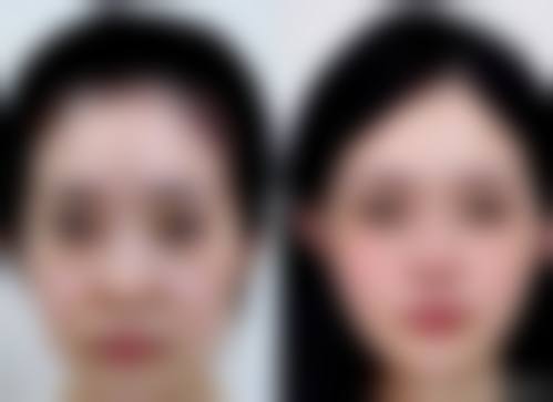 四、成都圣形医疗美容诊所特色项目