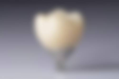 优惠活动详情:高性价比的口腔健康投资