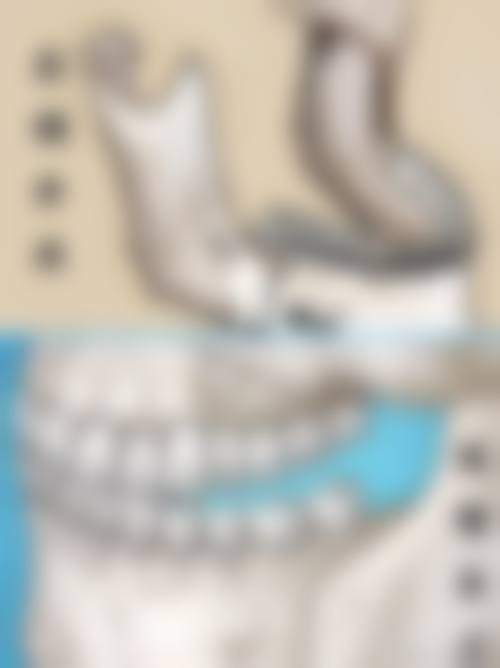 优惠活动详情:种植牙原价12000元-优惠价6800元