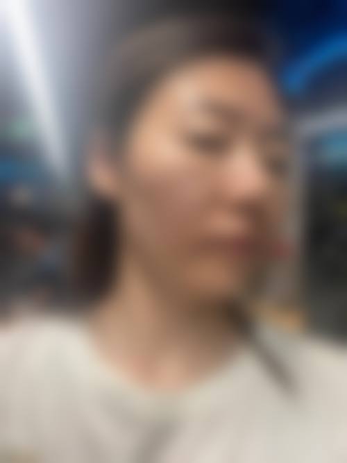 八、武汉新生植发医疗美容门诊部真实的患者评价