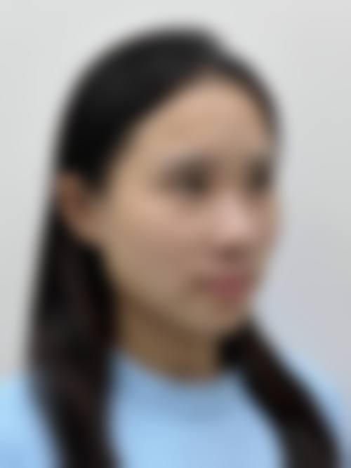 结语:选择正规医美,开启安心蜕变