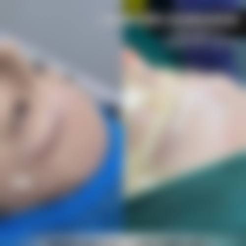 临床实例分享