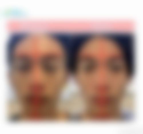 八、深圳首康医院医疗美容科真实的患者评价