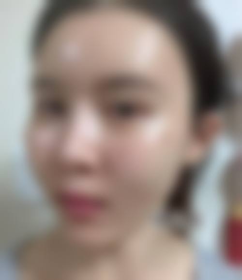 九、长沙市芙蓉区嘉禾医疗美容诊所真实的患者评价